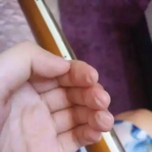女生弹​吉他​常见的困难和解决方法