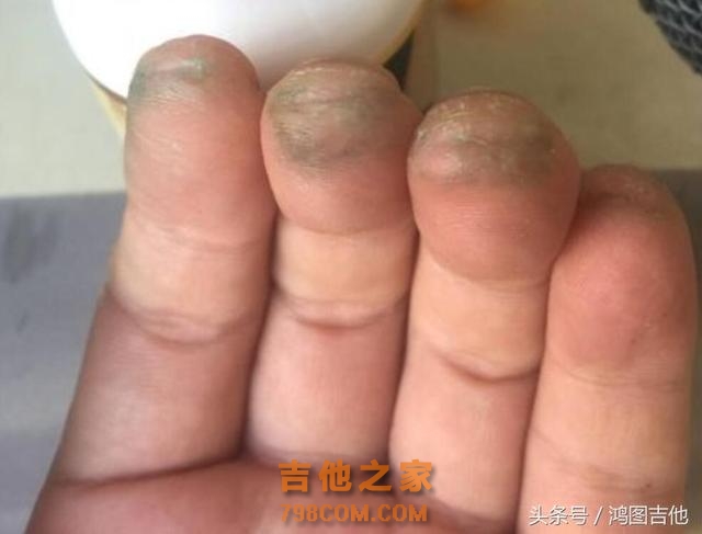 为什么有些朋友弹吉他，会导致左手手指头发黑呢，你发现了没有？