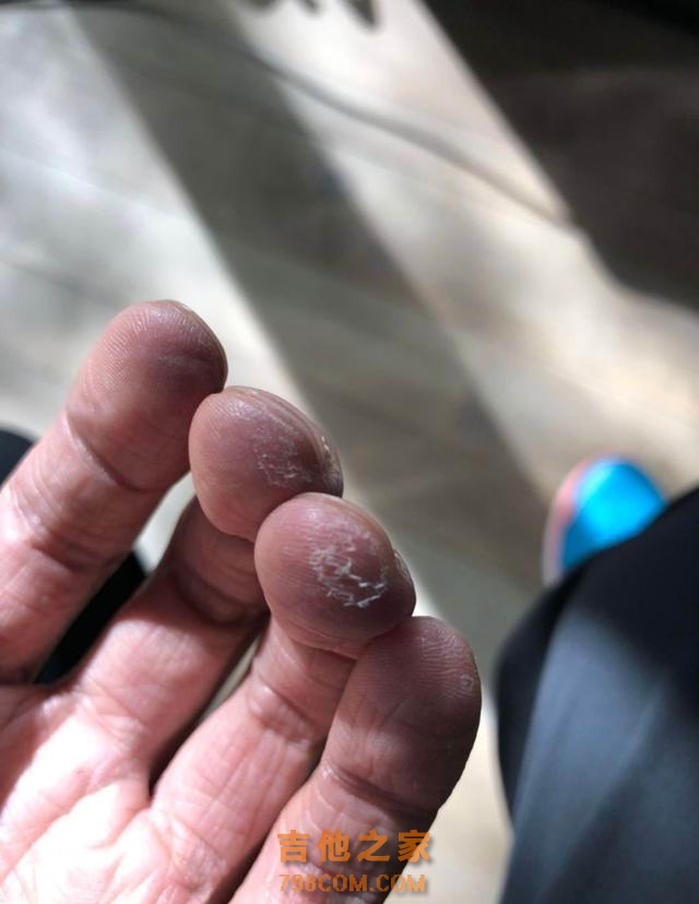 谢霆锋晒照给家里指纹锁录脚纹，手指头由于练吉他起了茧子