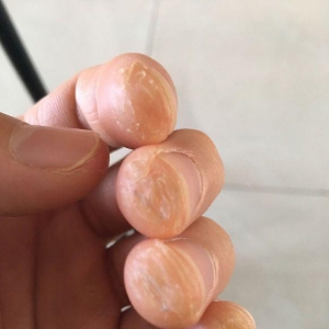 新手如何减轻弹吉他时按压和弦的疼痛