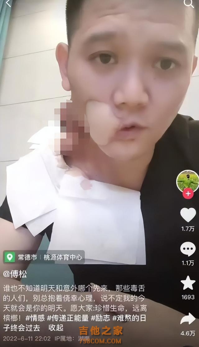 知名男歌手患口腔癌去世，拒绝手术治疗，临终前劝诫网友远离槟榔